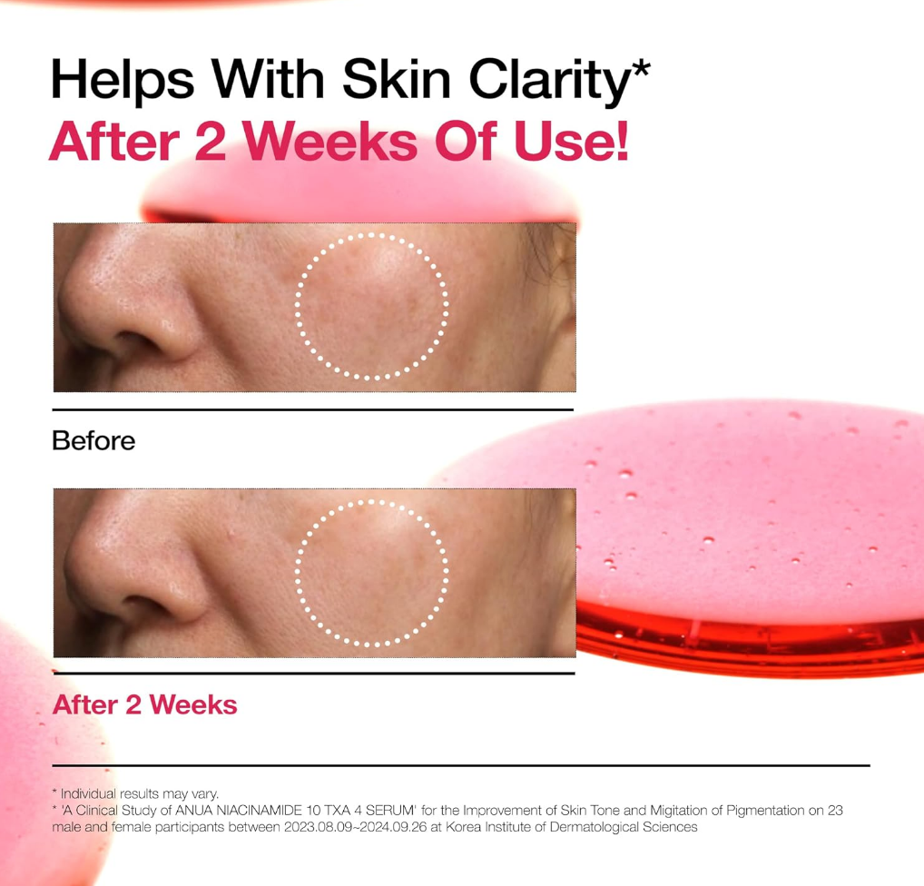 ANUA Niacinamide 10% + TXA 4% Dark Spot Correcting Serum 30ml