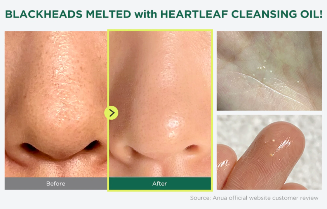 ANUA Heartleaf Pore Control Cleansing Oil 200ml